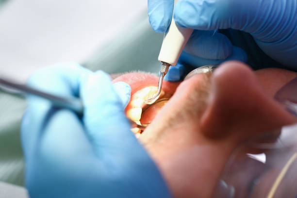 Best Broken or Chipped Tooth Repair in Washington, NC