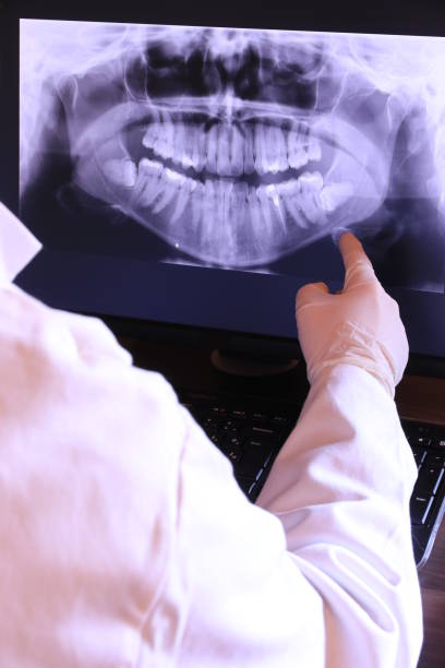 Best Dental Abscess Treatment in Washington, NC