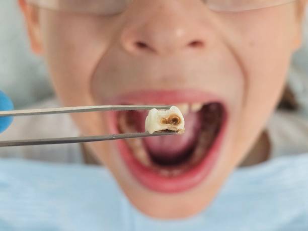 Best Emergency Denture Repair in Washington, NC